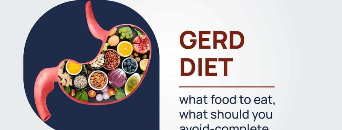 GERD Diet - what food to eat, what should you avoid-complete